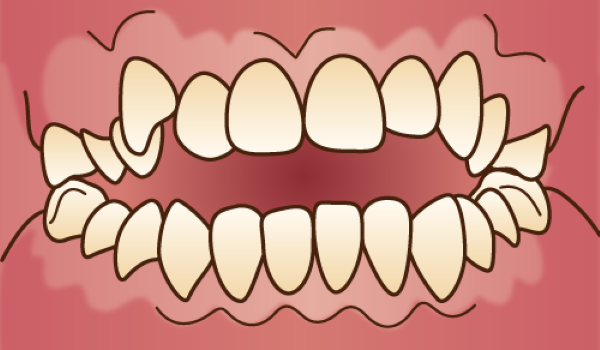 orthodontics032 - コピー