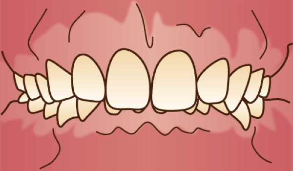 orthodontics038(1) - コピー
